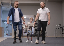 «Ключ в новую жизнь»: как протезисты спасали пациентов в ЛНР после тяжелых ранений
