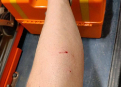 В Луганске собаки напали на девушку