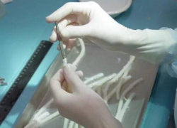 В клиники ЛНР доставили уникальные биологические протезы  