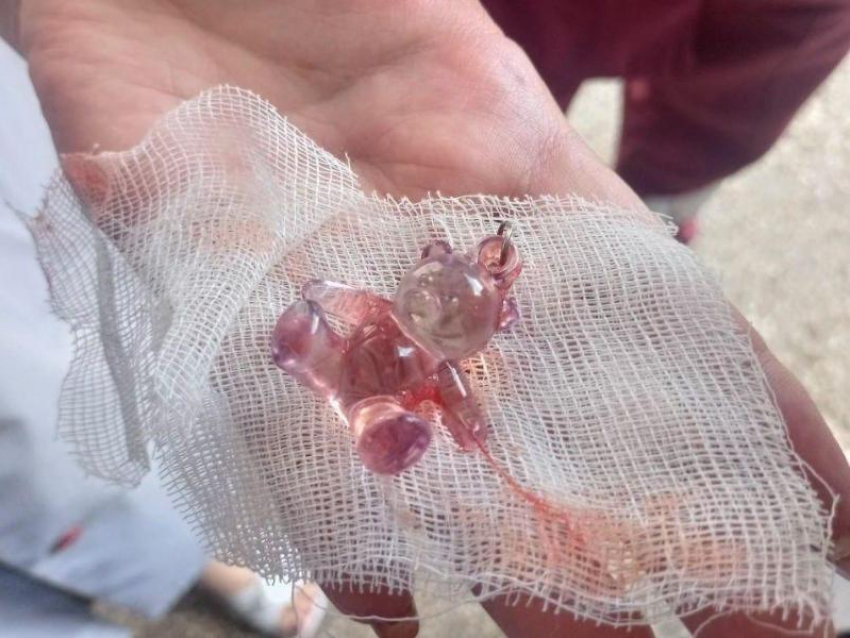 Стахановские врачи спасли жизнь трёхмесячного младенца: он едва не задохнулся брелоком 